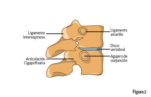 Lumbalgia