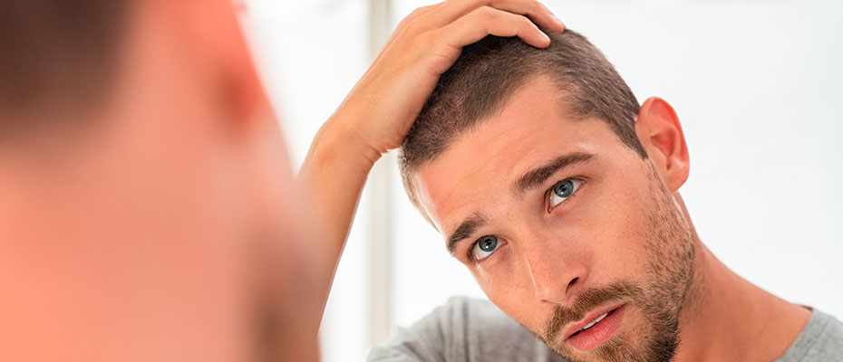 Hombre mirándose al espejo su alopecia