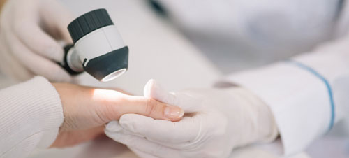 Doctora mirando la mano de una paciente con una lupa | Cáncer de piel: la importancia de detectarlo a tiempo Doctora mirando la mano de una paciente con una lupa | Cáncer de piel: la importancia de detectarlo a tiempo