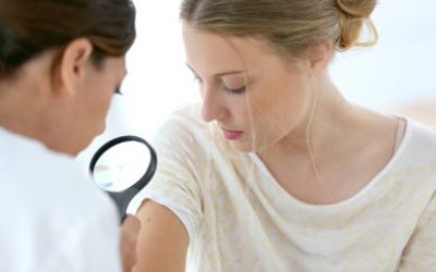 Cáncer de piel: la importancia de detectarlo a tiempo